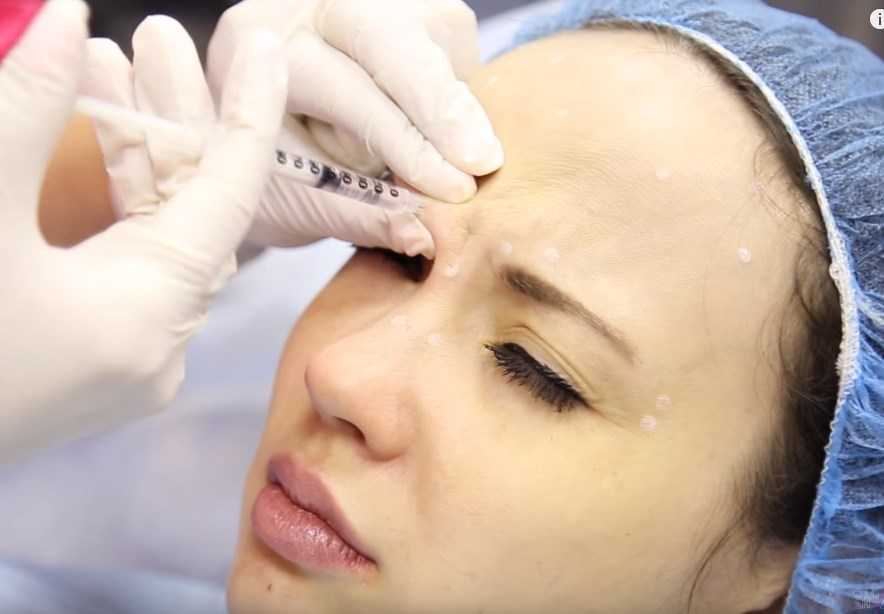 Мусульманское духовенство России одобрило инъекции ботокса для верующих