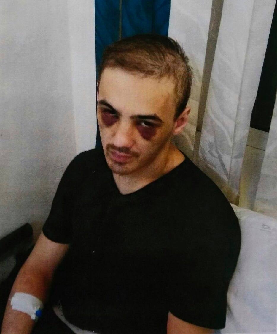 A tortured prisoner from Ingushetia complained of worsening epileptic seizures